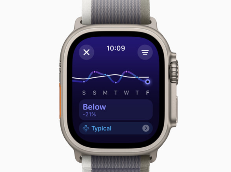 ساعة آبل Watch Series 11 تحسينات تقنية ومزايا صحية مرتقبة