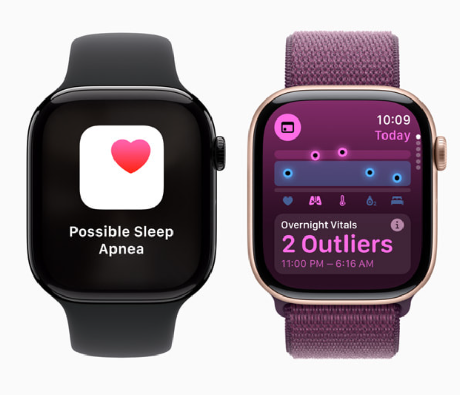 تحديثات واعدة في الأفق ما الجديد في نظام watchOS 12 لساعات آبل الذكية