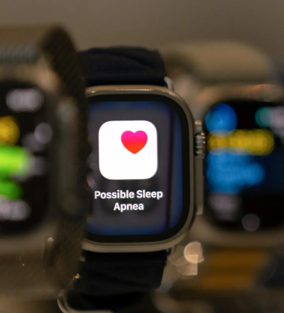 آبل تكشف عن ساعة Apple Watch Series 11 بميزة قياس ضغط الدم