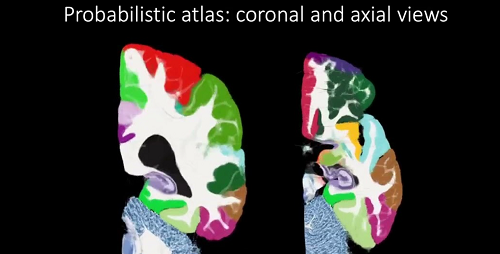 الذكاء الاصطناعي يرسم أدق خريطة ثلاثية الأبعاد للدماغ البشري إنجاز علمي يفتح آفاقًا جديدة لعلاج الأمراض العصبية