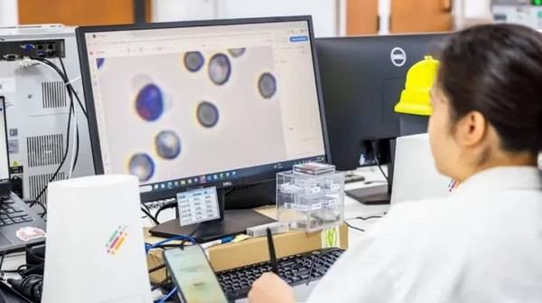 جهاز Proxima لتحليل الدم في المنزل.. نتائج خلال 20 دقيقة باستخدام قطرة دم واحدة